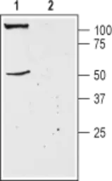 Anti-TRESK antibody used in Western Blot (WB). GTX16694