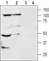 Anti-TRESK antibody used in Western Blot (WB). GTX16694