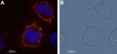 Anti-TRESK antibody used in Live cell imaging (LCI). GTX16694