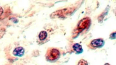 Anti-Neuropilin 1 antibody used in IHC (Paraffin sections) (IHC-P). GTX16786