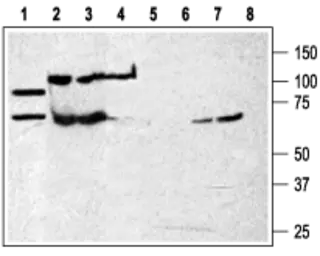 Anti-P2X7 antibody used in Western Blot (WB). GTX16827