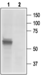 Anti-P2X3 antibody used in Western Blot (WB). GTX16876