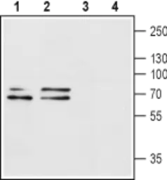 Anti-P2X1 antibody used in Western Blot (WB). GTX16925