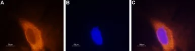 Anti-SCN3A antibody used in Immunocytochemistry/ Immunofluorescence (ICC/IF). GTX16937