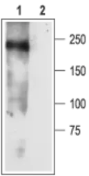 Anti-SCN3A antibody used in Western Blot (WB). GTX16937