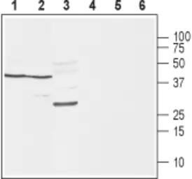 Anti-SCN1B antibody used in Western Blot (WB). GTX16973