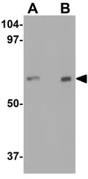 Anti-IL22 Receptor alpha 1 antibody used in Western Blot (WB). GTX16978