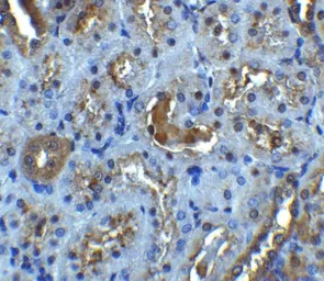 Anti-IL22 Receptor alpha 1 antibody used in IHC (Paraffin sections) (IHC-P). GTX16978