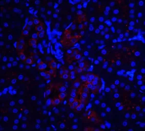 Anti-IL22 Receptor alpha 1 antibody used in IHC (Paraffin sections) (IHC-P). GTX16978