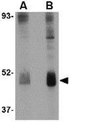 Anti-Wnt10b antibody used in Western Blot (WB). GTX17006