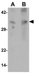 Anti-GRINA antibody used in Western Blot (WB). GTX17187