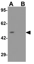 Anti-ADRM1 antibody used in Western Blot (WB). GTX17239