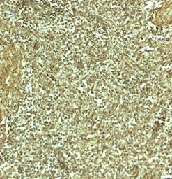 Anti-ADRM1 antibody used in IHC (Paraffin sections) (IHC-P). GTX17239