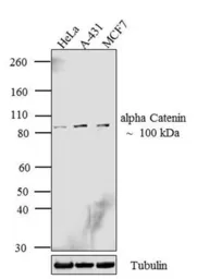 Anti-alpha Catenin antibody [1G5] used in Western Blot (WB). GTX17259