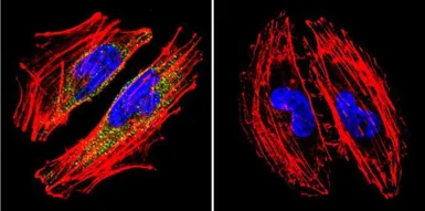 Anti-alpha Catenin antibody [1G5] used in Immunocytochemistry/ Immunofluorescence (ICC/IF). GTX17259