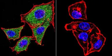 Anti-alpha Catenin antibody [1G5] used in Immunocytochemistry/ Immunofluorescence (ICC/IF). GTX17259