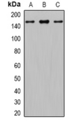 Anti-Gli1 antibody used in Western Blot (WB). GTX17495