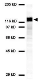 Anti-Desmoglein 3 antibody [5H10] used in Western Blot (WB). GTX17502