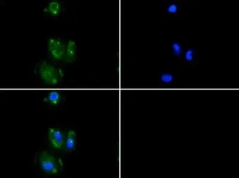 Anti-Desmoglein 3 antibody [5H10] used in Immunocytochemistry/ Immunofluorescence (ICC/IF). GTX17502