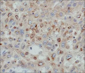 Anti-Desmoglein 3 antibody [5H10] used in IHC (Paraffin sections) (IHC-P). GTX17502