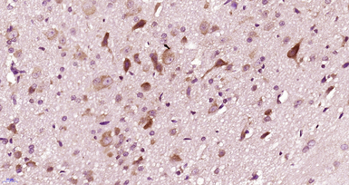 Anti-Dopamine Receptor D2 antibody used in IHC (Paraffin sections) (IHC-P). GTX17570