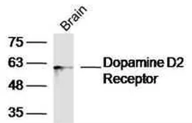 Anti-Dopamine Receptor D2 antibody used in Western Blot (WB). GTX17570