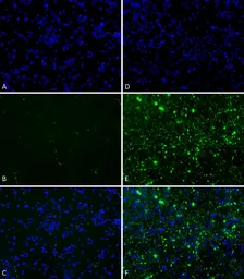 Human alpha Synuclein protein (active, Pre-Formed Fibrils). GTX17669-pro