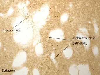 Human alpha Synuclein protein (active, Pre-Formed Fibrils). GTX17669-pro