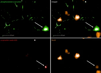 Human alpha Synuclein protein (active, Pre-Formed Fibrils). GTX17669-pro