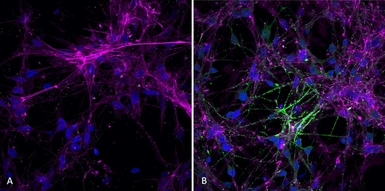 Human alpha Synuclein protein (active, Pre-Formed Fibrils). GTX17669-pro