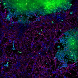 Human alpha Synuclein protein (active, Pre-Formed Fibrils). GTX17669-pro