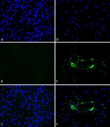 Mouse alpha Synuclein protein (active, Pre-Formed Fibrils). GTX17671-pro