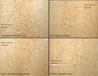 Mouse alpha Synuclein protein (active, Pre-Formed Fibrils). GTX17671-pro