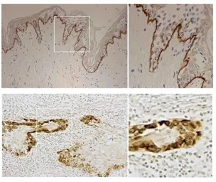 Anti-Laminin gamma 2 antibody [P2H] used in IHC (Paraffin sections) (IHC-P). GTX17686