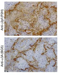 Anti-Laminin gamma 2 antibody [P2H] used in IHC (Paraffin sections) (IHC-P). GTX17686