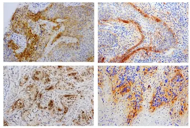 Anti-Laminin gamma 2 antibody [P2H] used in IHC (Paraffin sections) (IHC-P). GTX17686