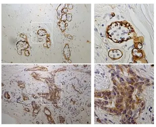 Anti-Laminin gamma 2 antibody [P2H] used in IHC (Paraffin sections) (IHC-P). GTX17686