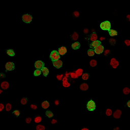 Anti-ZAP70 antibody [ZAP70/2035] used in Immunocytochemistry/ Immunofluorescence (ICC/IF). GTX17837