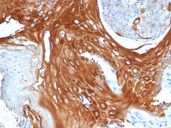 Anti-Cytokeratin 6 antibody [KRT6A/2368] used in IHC (Paraffin sections) (IHC-P). GTX17910