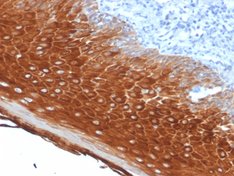 Anti-Cytokeratin 6 antibody [KRT6A/2368] used in IHC (Paraffin sections) (IHC-P). GTX17910