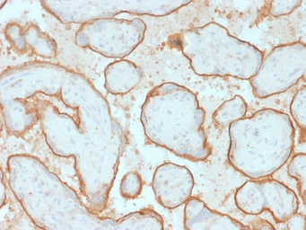 Anti-EGFR antibody [GFR/2341] used in IHC (Paraffin sections) (IHC-P). GTX17955