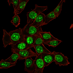 Anti-Ki67 antibody [MKI67/2465] used in Immunocytochemistry/ Immunofluorescence (ICC/IF). GTX17972