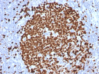 Anti-Ki67 antibody [MKI67/2465] used in IHC (Paraffin sections) (IHC-P). GTX17972