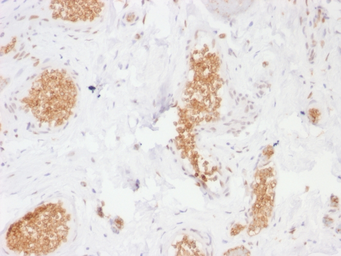 Anti-GluT1 antibody [GLUT1/2476] used in IHC (Paraffin sections) (IHC-P). GTX17991