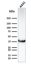 Anti-GluT1 antibody [GLUT1/2476] used in Western Blot (WB). GTX17991