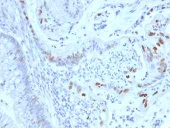 Anti-Cyclin E1 antibody [CCNE1/2460] used in IHC (Paraffin sections) (IHC-P). GTX18047