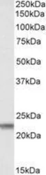 Anti-Claudin 14 antibody, C-term used in Western Blot (WB). GTX19035