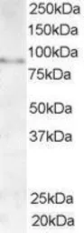 Anti-AKAP3 antibody, C-term used in Western Blot (WB). GTX19046