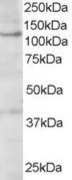 Anti-HPS3 antibody, C-term used in Western Blot (WB). GTX19047