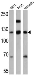 Anti-P-Cadherin antibody [6A9] used in Western Blot (WB). GTX19350